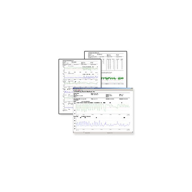 Logiciel NVision pour Oxymètres